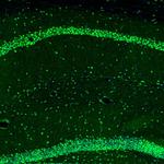UBF-1 Antibody in Immunohistochemistry (Paraffin) (IHC (P))
