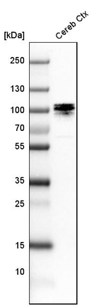 UBF-1 Antibody in Western Blot (WB)