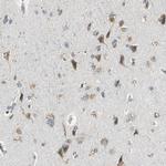 ALDH4A1 Polyclonal Antibody