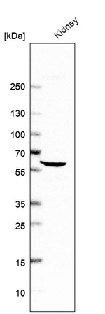 ALDH4A1 Antibody in Western Blot (WB)