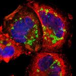 TIP47 Polyclonal Antibody