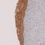 TIP47 Antibody in Immunohistochemistry (Paraffin) (IHC (P))