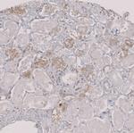 TIP47 Antibody in Immunohistochemistry (Paraffin) (IHC (P))