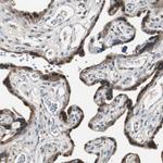 TIP47 Antibody in Immunohistochemistry (Paraffin) (IHC (P))