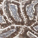 TIP47 Antibody in Immunohistochemistry (Paraffin) (IHC (P))