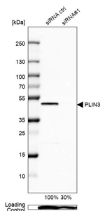 TIP47 Antibody in Western Blot (WB)