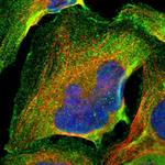 Ubiquilin 2 Polyclonal Antibody