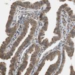 Ubiquilin 2 Antibody in Immunohistochemistry (Paraffin) (IHC (P))