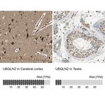 Ubiquilin 2 Antibody