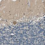 ME1 Antibody in Immunohistochemistry (Paraffin) (IHC (P))