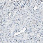 ME1 Antibody in Immunohistochemistry (Paraffin) (IHC (P))