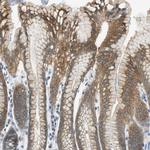 ME1 Antibody in Immunohistochemistry (Paraffin) (IHC (P))