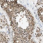 ME1 Polyclonal Antibody