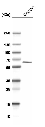 ME1 Antibody in Western Blot (WB)