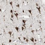 MPG Antibody in Immunohistochemistry (Paraffin) (IHC (P))