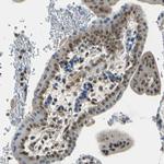 p21 ARC Antibody in Immunohistochemistry (Paraffin) (IHC (P))