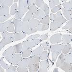 p21 ARC Antibody in Immunohistochemistry (Paraffin) (IHC (P))