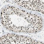 p21 ARC Antibody in Immunohistochemistry (Paraffin) (IHC (P))