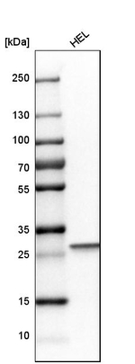Carbonic Anhydrase I Antibody in Western Blot (WB)