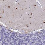 SCGN Antibody in Immunohistochemistry (Paraffin) (IHC (P))