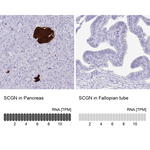 SCGN Antibody in Immunohistochemistry (Paraffin) (IHC (P))