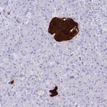SCGN Antibody in Immunohistochemistry (Paraffin) (IHC (P))