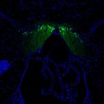 SCGN Antibody in Immunohistochemistry (Paraffin) (IHC (P))