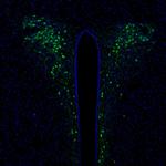 SCGN Antibody in Immunohistochemistry (Paraffin) (IHC (P))