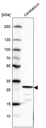 SCGN Antibody in Western Blot (WB)