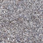 ZNF396 Antibody in Immunohistochemistry (Paraffin) (IHC (P))