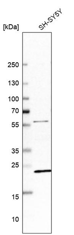 ZNF396 Antibody in Western Blot (WB)