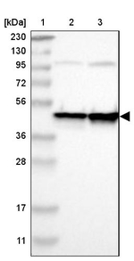 FEN1 Antibody in Western Blot (WB)