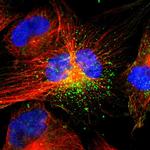 ACAA1 Polyclonal Antibody