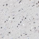 ACAA1 Antibody in Immunohistochemistry (Paraffin) (IHC (P))