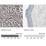 ACAA1 Antibody in Immunohistochemistry (Paraffin) (IHC (P))