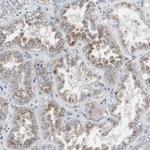ACAA1 Antibody in Immunohistochemistry (Paraffin) (IHC (P))