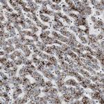 ACAA1 Antibody in Immunohistochemistry (Paraffin) (IHC (P))