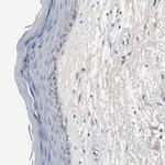 ACAA1 Antibody in Immunohistochemistry (Paraffin) (IHC (P))