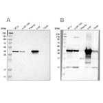 ACAA1 Antibody in Western Blot (WB)
