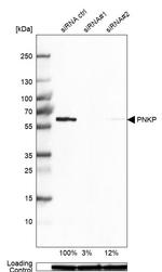 PNK Antibody