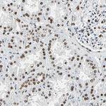 XRCC4 Antibody in Immunohistochemistry (Paraffin) (IHC (P))