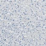 XRCC4 Antibody in Immunohistochemistry (Paraffin) (IHC (P))