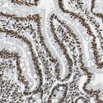 XRCC4 Antibody in Immunohistochemistry (Paraffin) (IHC (P))