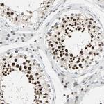 XRCC4 Antibody in Immunohistochemistry (Paraffin) (IHC (P))