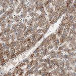 Hepsin Polyclonal Antibody