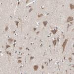 GLYCTK Polyclonal Antibody