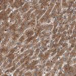 GLYCTK Antibody in Immunohistochemistry (Paraffin) (IHC (P))
