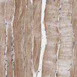 GLYCTK Antibody in Immunohistochemistry (Paraffin) (IHC (P))