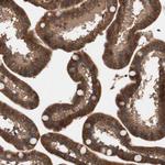 GLYCTK Antibody in Immunohistochemistry (Paraffin) (IHC (P))