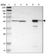 GLYCTK Antibody in Western Blot (WB)